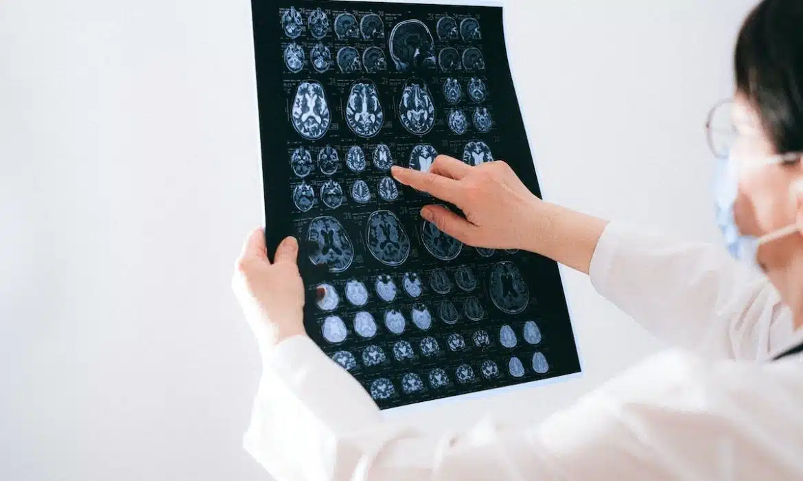 Problèmes de mémoire liés à l’âge : astuces pour ralentir le déclin cognitif