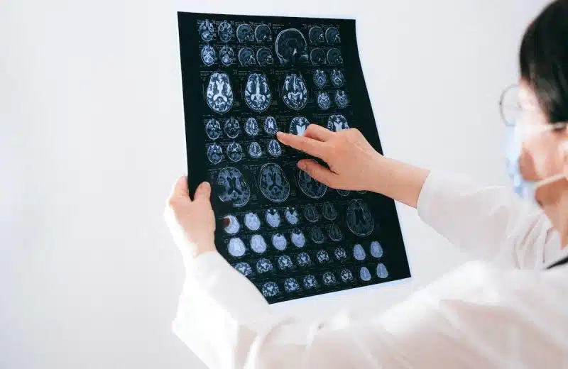 Problèmes de mémoire liés à l’âge : astuces pour ralentir le déclin cognitif