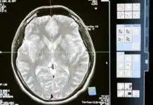 Prendre soin de sa mémoire au fil des années : les meilleures pratiques
