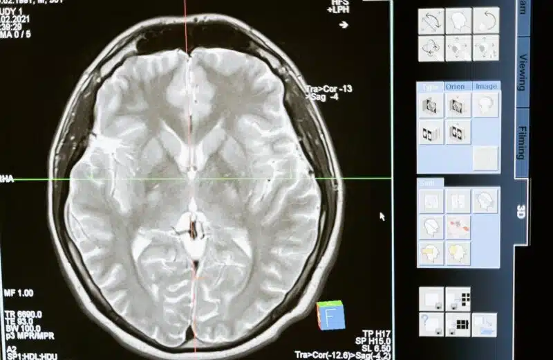 Prendre soin de sa mémoire au fil des années : les meilleures pratiques