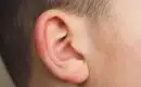 Tout ce que vous devez savoir sur le bouton sur le lobe de l’oreille: Causes, traitements