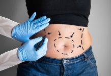 Quels médecins peuvent effectuer une Abdominoplastie ?